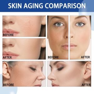 سيروم أورديناري نياسيناميد – The Ordinary Niacinamide 10% + Zinc 1%